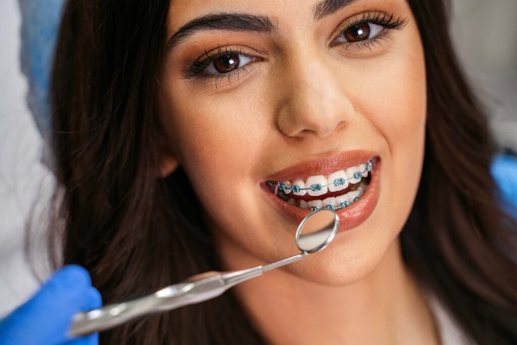 Best Braces Treatment at Root Care Dental Clinic