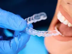 Clear Aligners Treatment