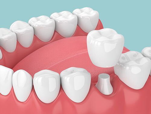 Advanced Gum Surgery Treatment
