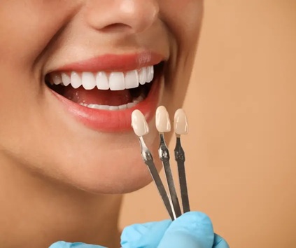 Dental Veneers Treatment