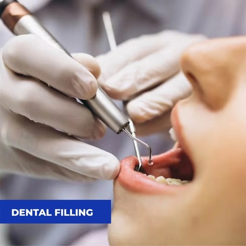 Dental Restoration Treatment