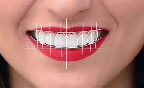 Dental Smile Designing Treatment