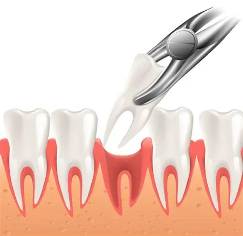 Professional Tooth Extraction Procedure